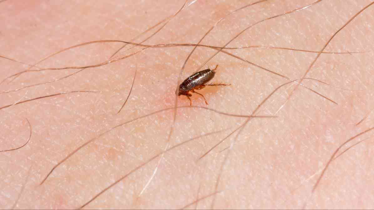Flea Infestation - Flea Jump onto Human