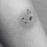 Identifying Spider Bites, Symptoms and Treatment