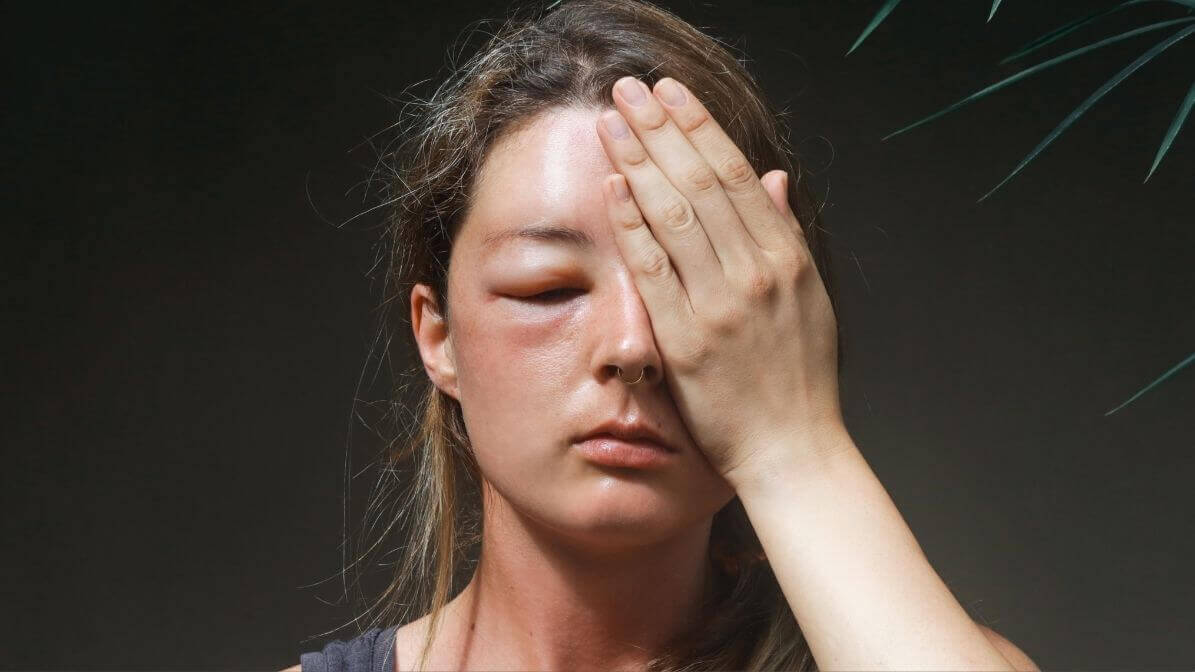 Appropriate Treatment | Innovative Pest Sdn Bhd Appropriate Treatment
